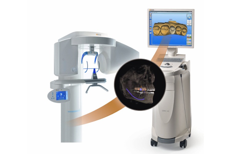 Artistic rendering of the CEREC 3D imaging crown making machine 