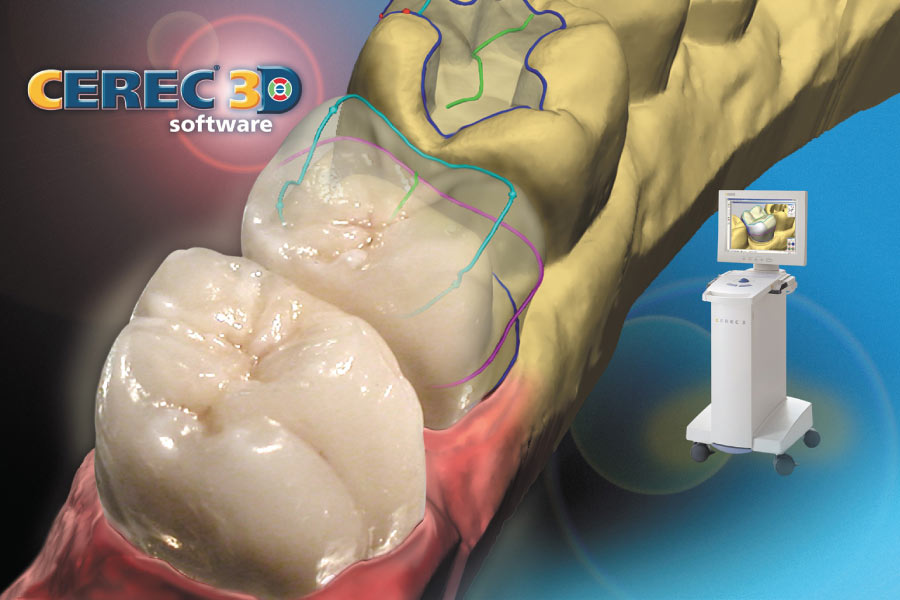 Model of teeth and CEREC's imaging machine.